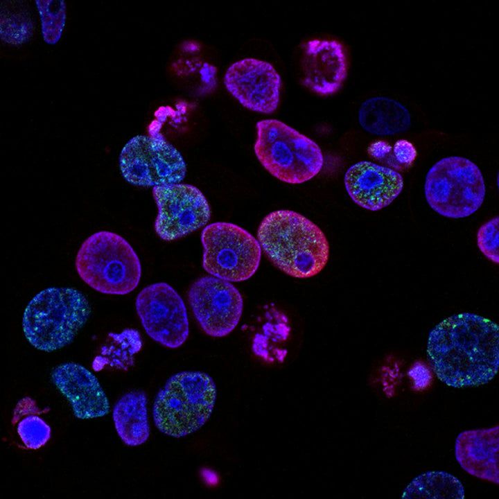Microbioma intestinal y rendimiento atlético — bacterias intestinales bajo microscopio electrónico de barrido colorizado