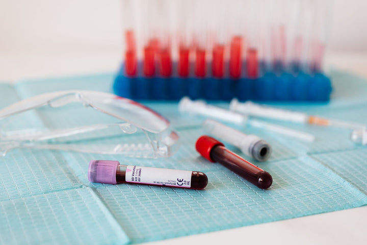 Investigador sosteniendo un gradilla de tubos de muestra de sangre en un laboratorio clínico, ilustrando la investigación sobre biomarcadores del envejecimiento